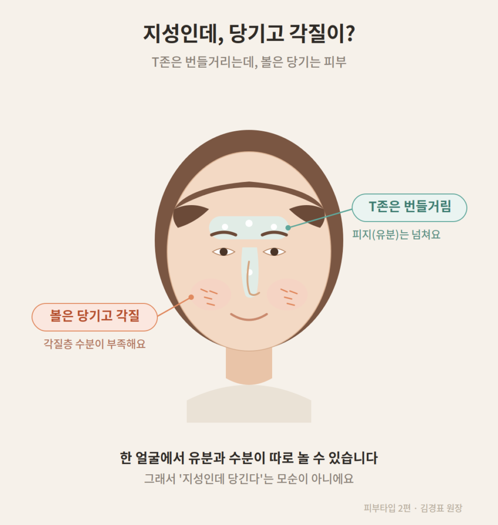 T존은 번들거리고 양 볼은 당기며 각질이 일어나는 지성 속건조 피부 상태를 보여주는 얼굴 일러스트